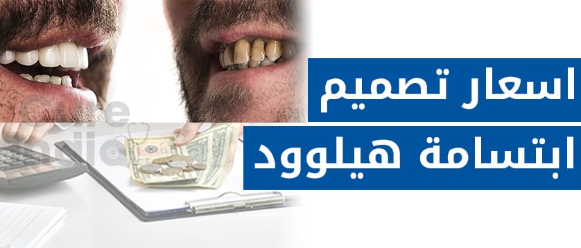 اسعار تصميم ابتسامة هيلوود